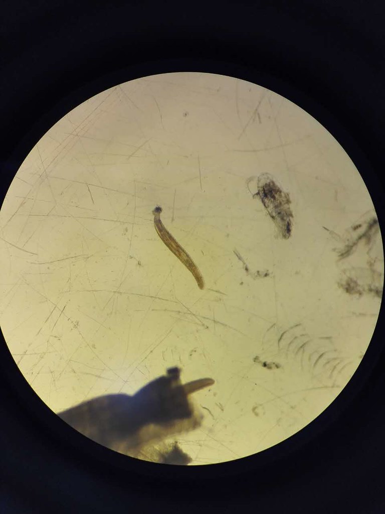 trematode from gut of larval fish